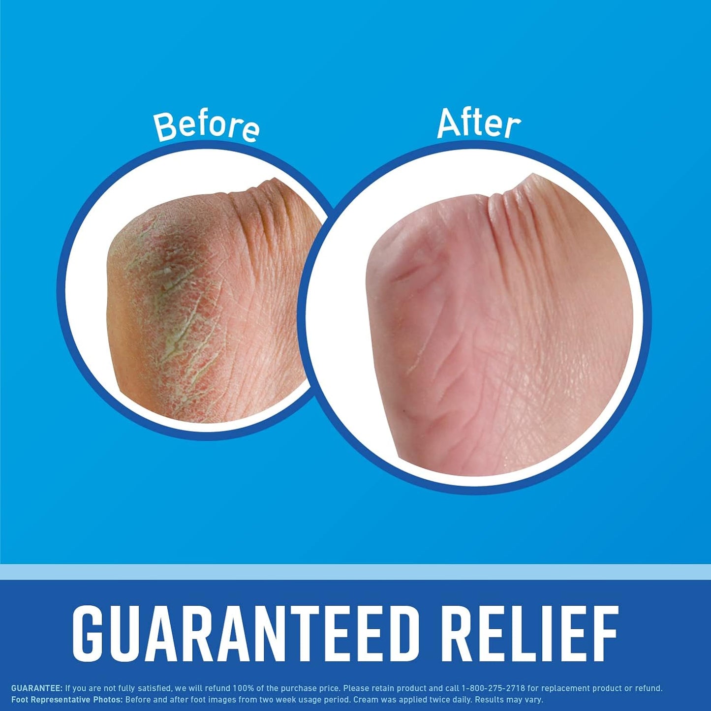 O'Keeffe's Working Hands Hand Cream, 6.8 oz Jar and Healthy Feet Foot Cream, 6.4 oz Jar - Repairing Skincare for Extremely Dry, Cracked Hands and Feet