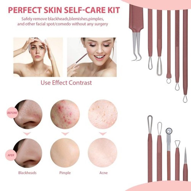 JPNK Blackhead Remover Tool Comedones Extractor Acne Removal Kit for Blemish, Whitehead Popping, 6 Pcs Zit Removing for Nose Face Tools with a Leather Bag (Pink)