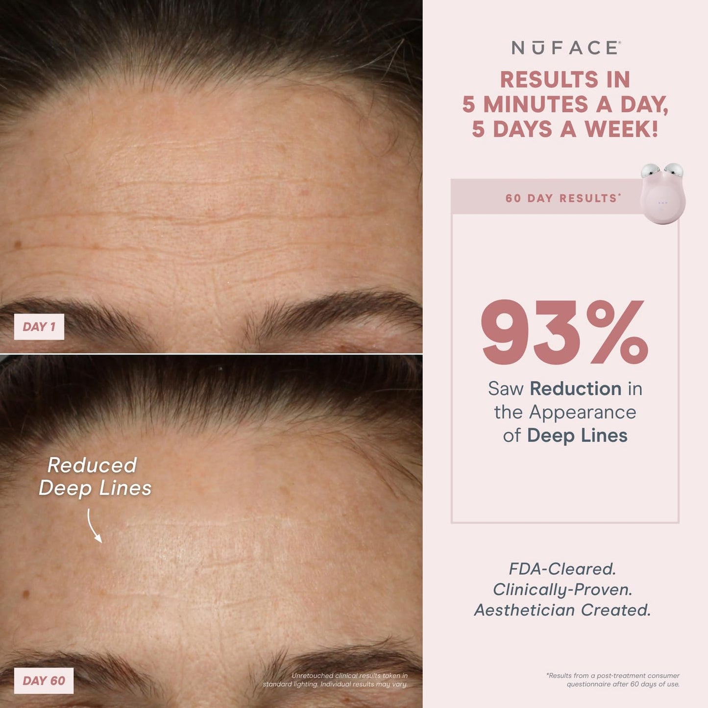 NuFACE MINI+ Microcurrent Facial Device Kit - FDA Cleared Face Sculpting Device to Contour, Lift & Tone + Microcurrent Gel Activator - NuBLUE