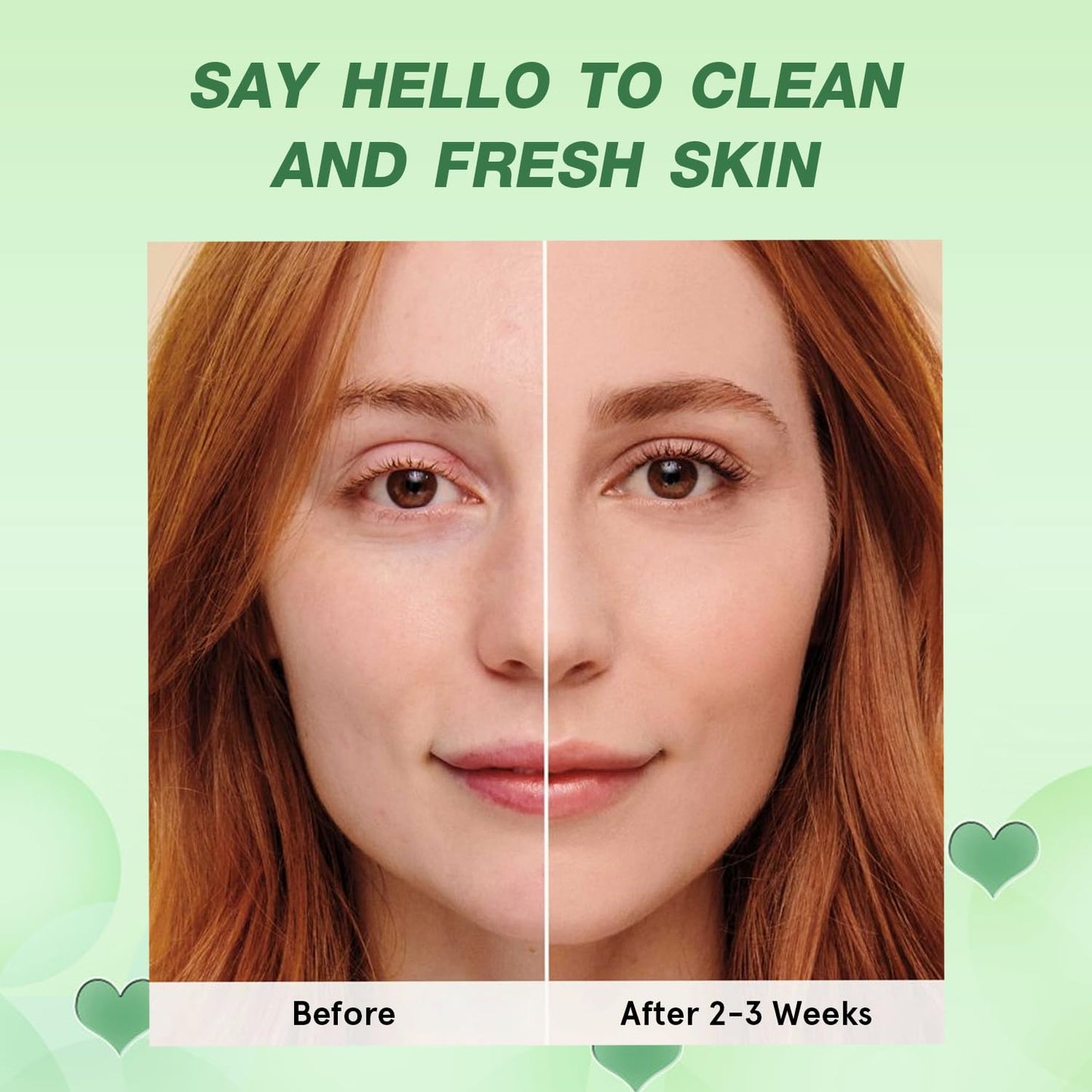 Green Tea Deep Cleanse Mask, Blackhead Remover with Green Tea Extract, Deep Cleanse Face Mask Stick for Deep Pore Cleansing, Oil Control, Moisturizing, and Shrink Blackheads for Men and Women, 5PCS