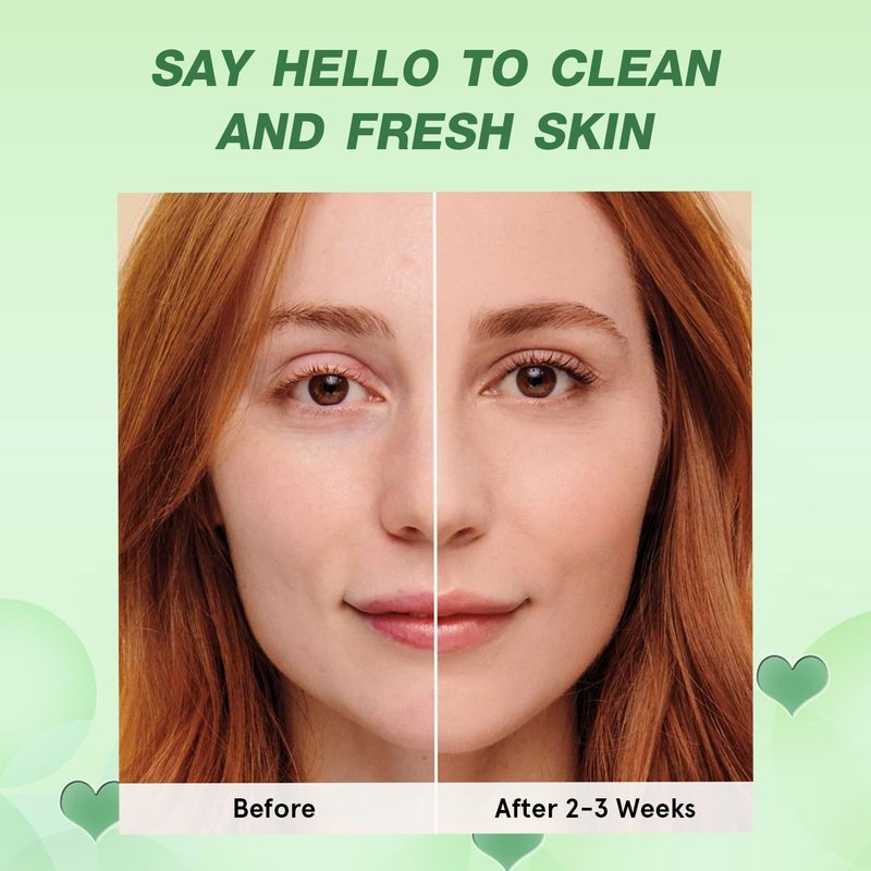 Green Tea Deep Cleanse Mask, Blackhead Remover with Green Tea Extract, Deep Cleanse Face Mask Stick for Deep Pore Cleansing, Oil Control, Moisturizing, and Shrink Blackheads for Men and Women, 5PCS