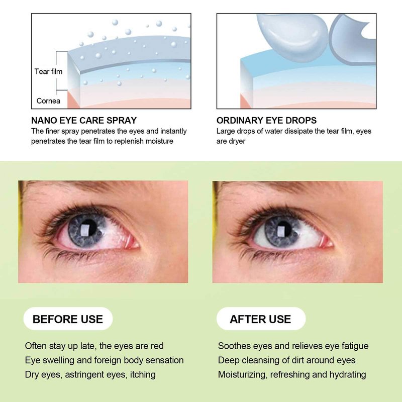 Brrnoo Eye Spray USB Charging Handheld Eye Care Spray, Mist for Tired and Dry, Portable Moisturizing Soothing Machine New moisturizing instrument cyan blue