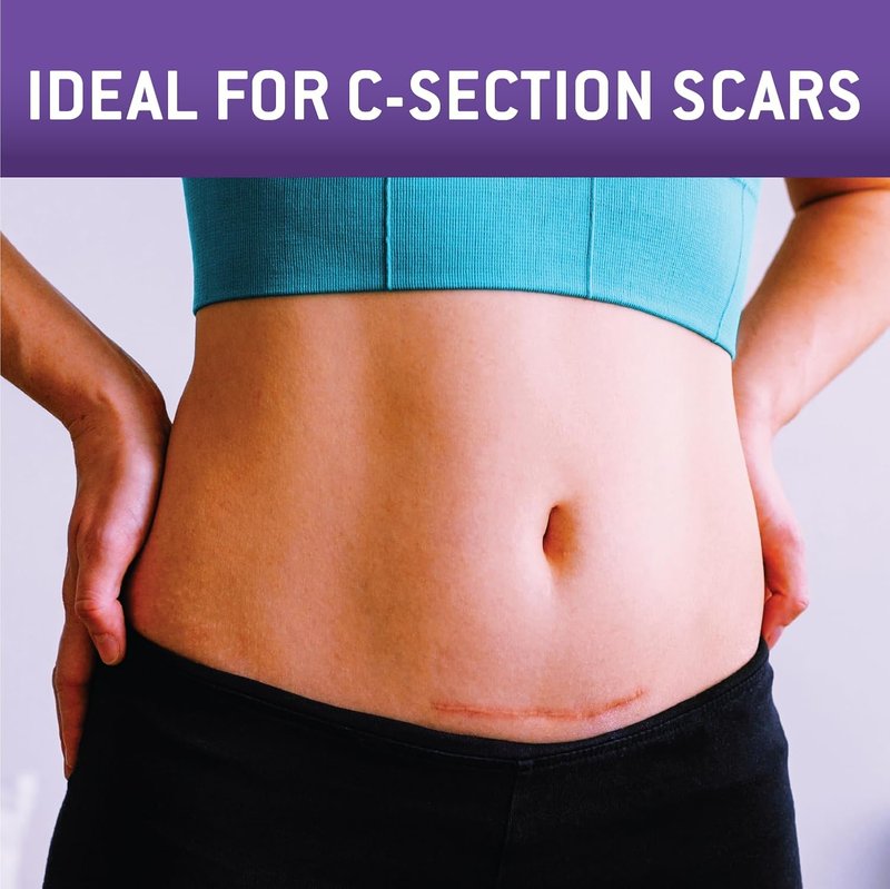 Care Science C-Section Recovery Scar Sheets - Silicone, Reusable, 1.5in x 7in, 8ct | Reduce C-Section, Keloid & Acne Scars