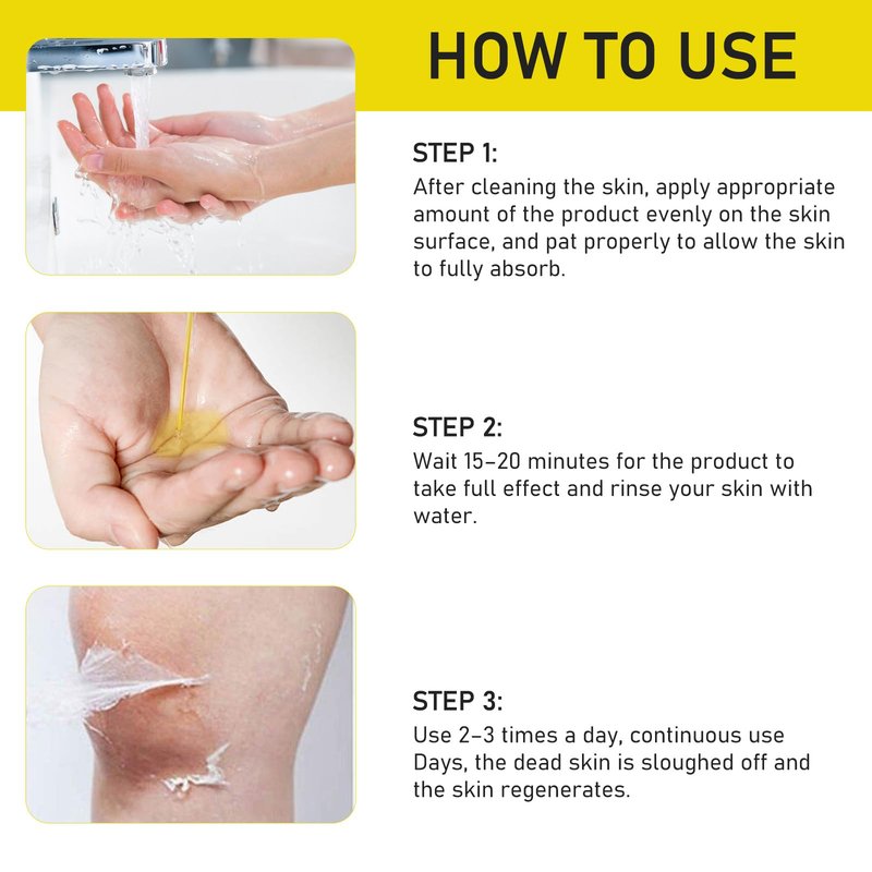 AOPEIBOTO Yellow Peeling Oil for Dark Skin, Extra Strong Peel Oil for Body Hands Arms Feet Legs Dark Knuckle Dead Skin Exfoliating, 3.38 fl.oz/100 ml