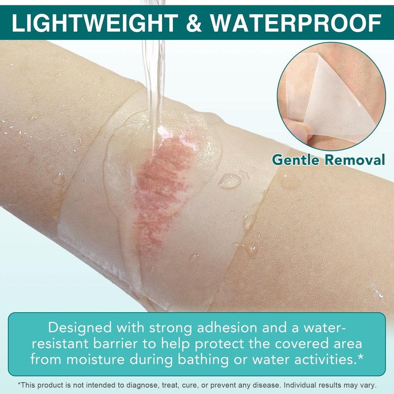 Hydrocolloid Bandages, Medical Grade Hydrocolloid Roll for Wound Care, Waterproof & Flexible Wound Dressing Roll, Extra Large Hydrocolloid Patch Bandages with Self-Adhesive-2in*11.8ft