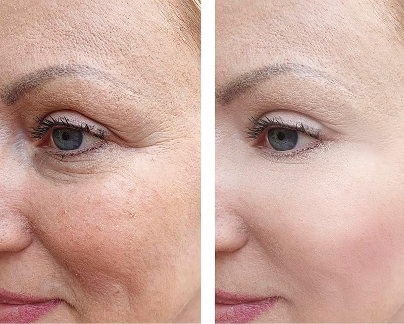 Vitality Precision Skin Advanced AGE Interrupter Cream - Anti-Aging Moisturizer 1.6 oz