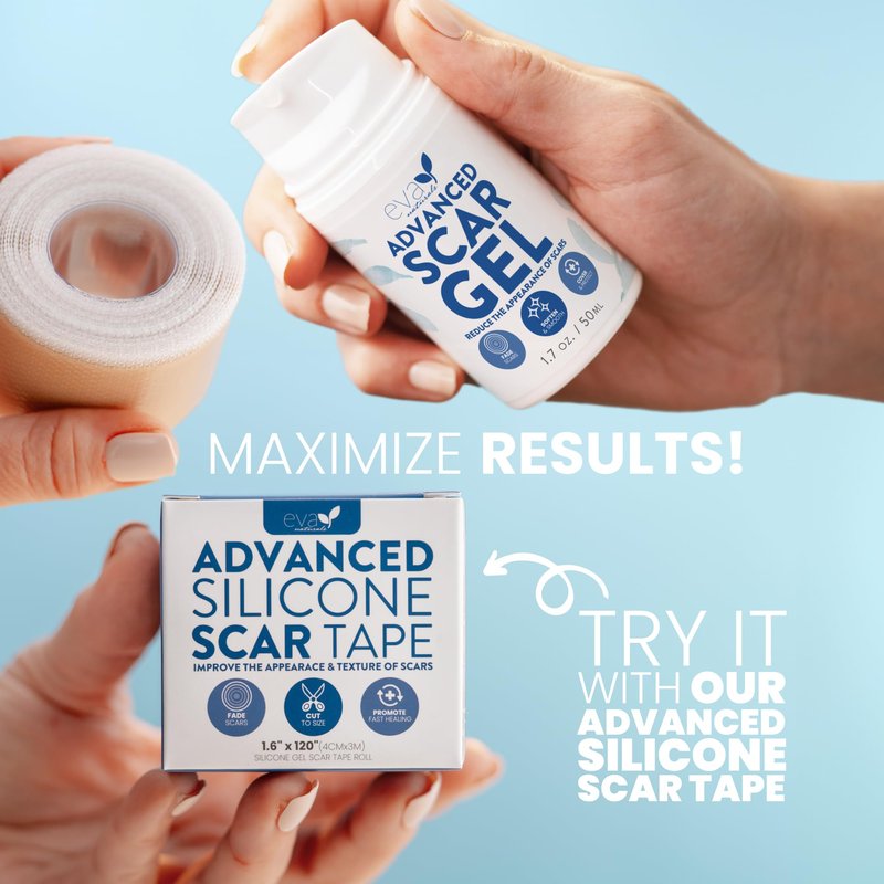 Eva Naturals Advanced Scar Gel for Surgical Scars, Reduces The Appearance of Old & New Keloid, C-Section, Acne Scars, Retinol & Allantoin, Scar Treatment for Surgical Scars & Keloid Scar Treatment