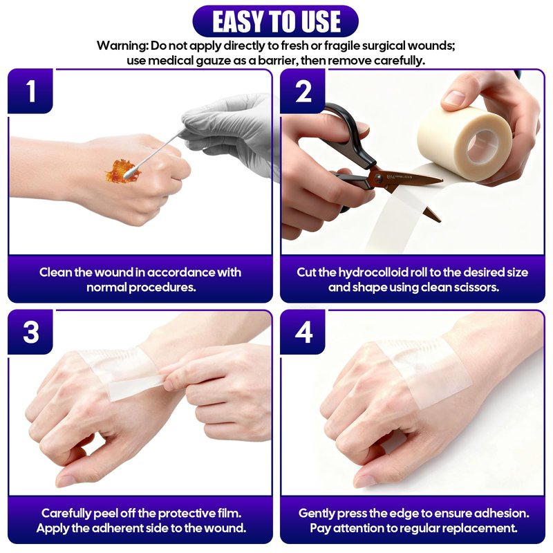 Hydrocolloid Roll for Wound Care, Medical-Grade Absorbent Pimple Patch Roll, Hydrocolloid Bandages with Self-Adhesive, Waterproof, DIY Size & Shape First Aid Kit Essential(2in*4.8ft)