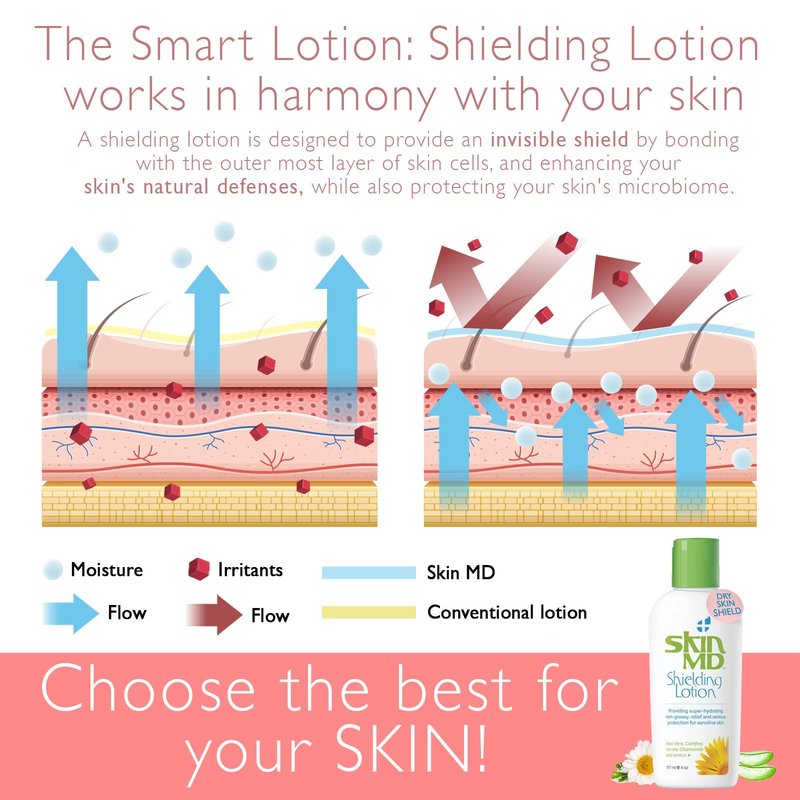 Skin MD Shielding Lotion Hydrating Body Lotion for Sensitive Skin with Dispenser | Non-Greasy, Fast-Absorbing Moisturizer with Plant-Based Ingredients, Eczema & Psoriasis Relief - 8oz