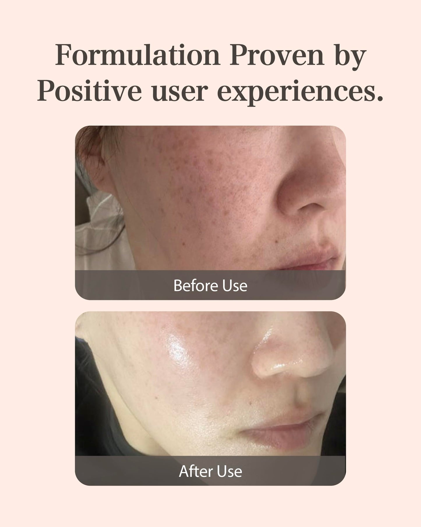 Mastina Mastic Ampoule (Dropper Type, 0.5fl oz) - Dark Spot Remover Face Serum for Even Skin Tone. Fermented Mastic Gum. White Mastic Complex 63% + Tranexamic Acid 2% + Niacinamide 5%