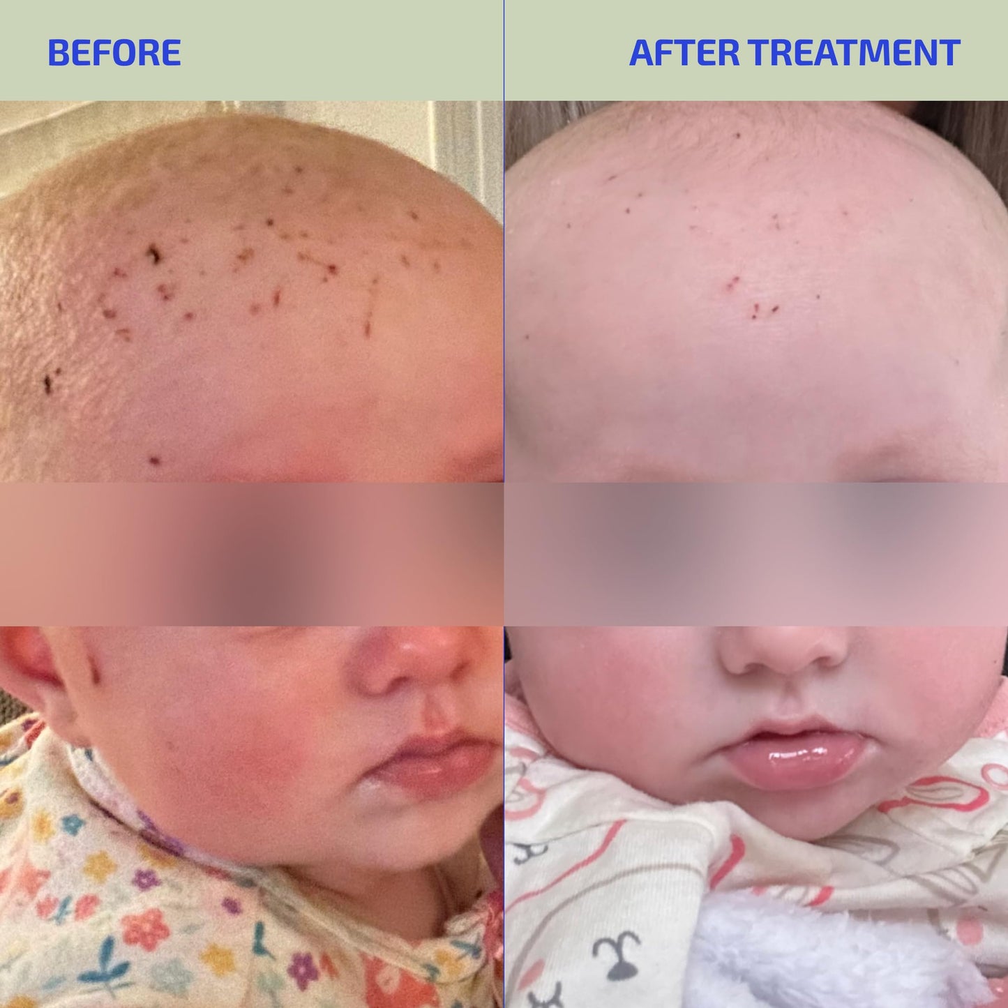 Codex Labs Infant & Toddler Skin Barrier Support - Unflavored L-Histidine Supplement with Vitamins & Minerals - 30 Servings, Tested for Sensitive & Eczema-Prone Skin - Made in USA