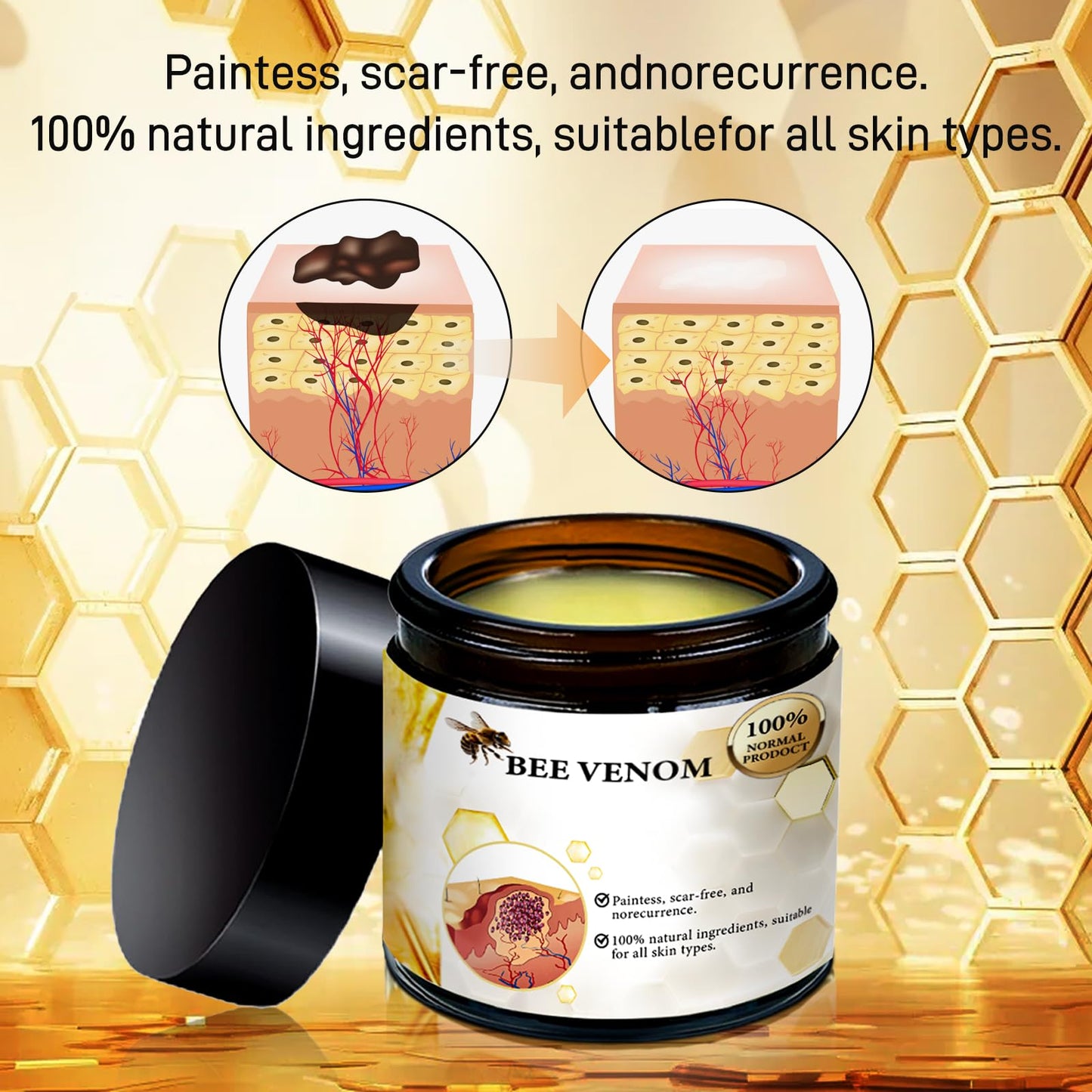 Bee Venom Repair Cream,Bee Venom Moisturizing and Nourishing Cream,Professional Bee Venom Repair Cream,Bee Venom Treatment Cream for All Parts of The Body,Suitable for All Skin Types of Men and Women