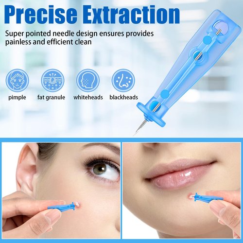 200Pcs Sterile Needles for Pimples, Disposable Acne Needles Effective Blemish and Blackhead Removal Tools for Clear Skin