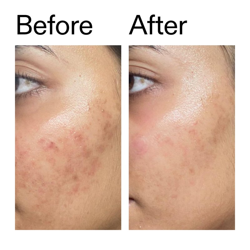The INKEY List Ectoin Hydro-Barrier Serum, Advanced Dual-Action Serum, Boosts Hydration, Builds Stronger Skin Barrier, Lightweight Texture