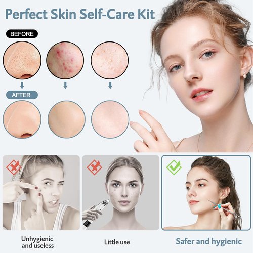 MENOLY Pimple Popper Tool Kit 10 Pcs, Pimple Blackhead Remover Tool Zit Popper for Blemish, Pimple Comedone Extractor Acne Tool for Blackheads, Acnes, Whiteheads Nose Face Tools with Leather Bag