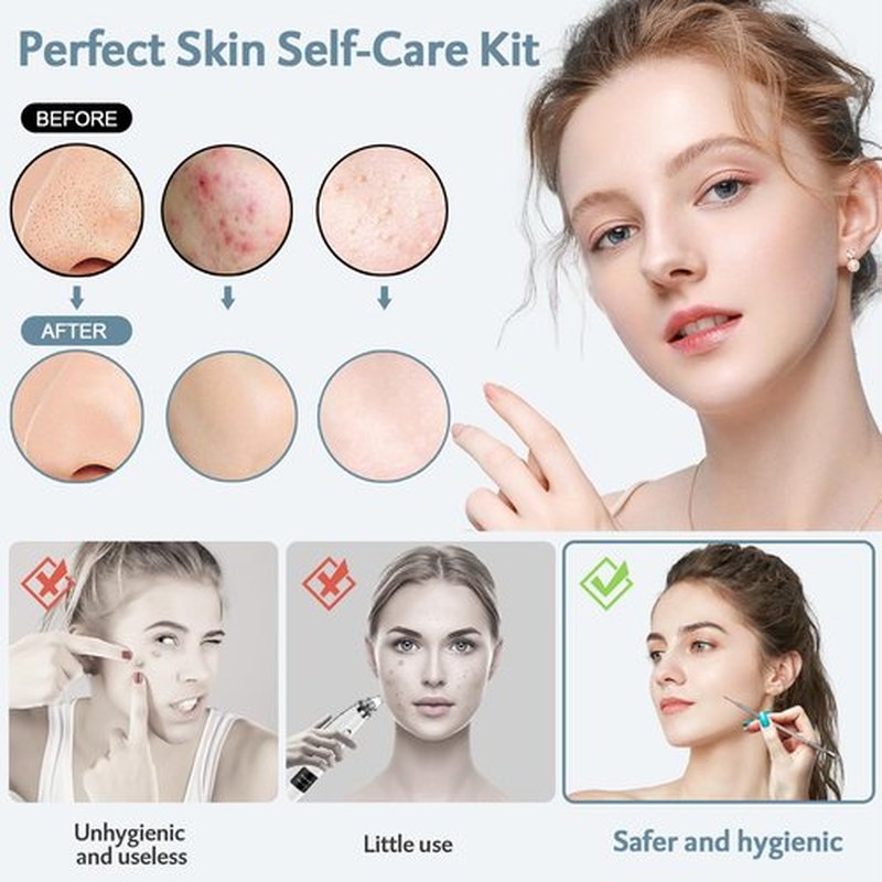 MENOLY Pimple Popper Tool Kit 10 Pcs, Pimple Blackhead Remover Tool Zit Popper for Blemish, Pimple Comedone Extractor Acne Tool for Blackheads, Acnes, Whiteheads Nose Face Tools with Leather Bag