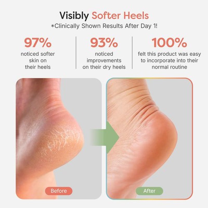 ZenToes Moisturizing Sleep Socks with Vitamin E, Olive Oil and Jojoba Seed Oil to Soften and Hydrate Dry Cracked Heels (Fuzzy Black, Regular)