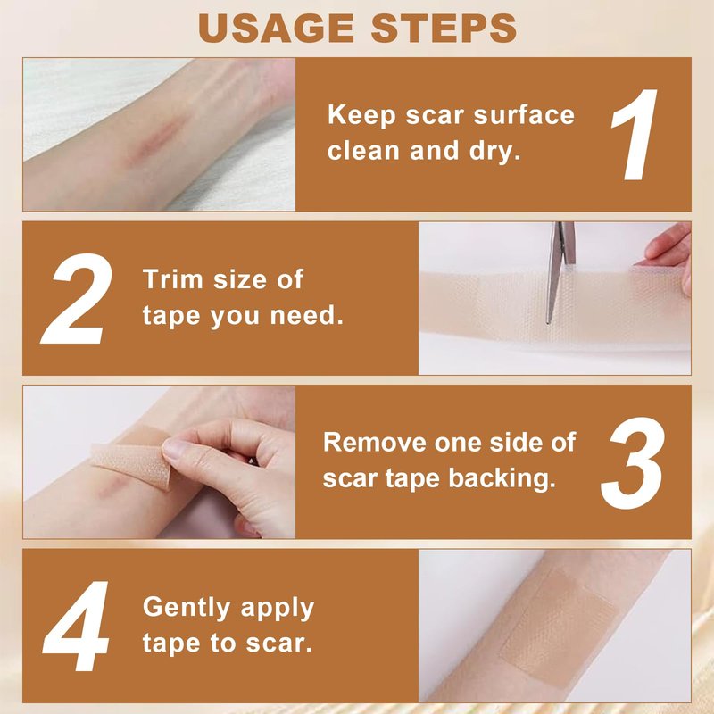 Silicone Scar Sheets for C-Section & Surgery - 3M Roll (1.6"x118") - Reusable & Hypoallergenic Scar Tape to Fade Scars from Acne, Burns, Keloid | Doctor Recommended