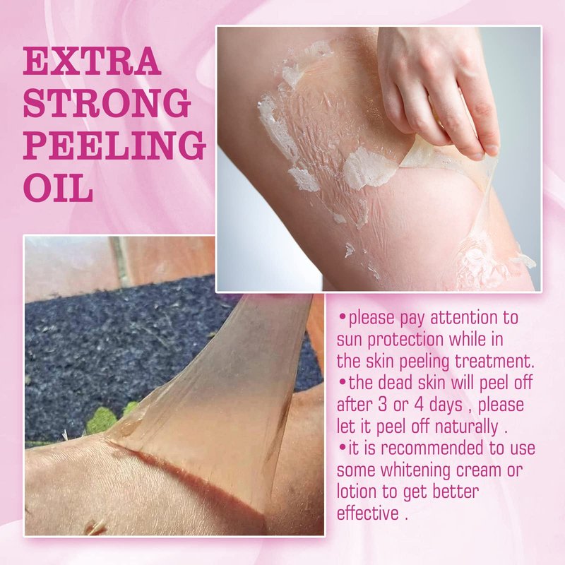 Generic Extra Strong Peeling Oil, Peeling Oil for Dark Skin, Yellow Peeling Oil, Exfoliating Peeling Solution for Hand Feet, Chemical Peel for Face, 110ML / 3.88 OZ (1 PCS)