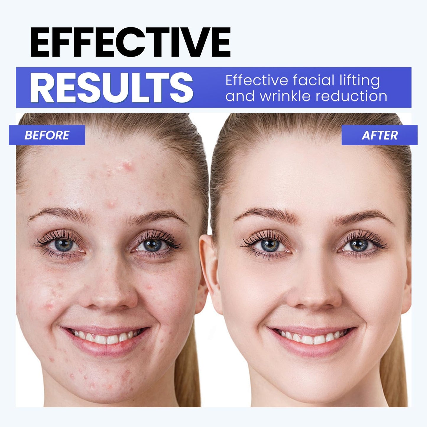 Microcurrent Facial Device,Latest Red Light Technology,Enhances The Ability to Lift The Face and Tighten The Skin,USB Red Light Device for Face,for Facial Wrinkle Equipment
