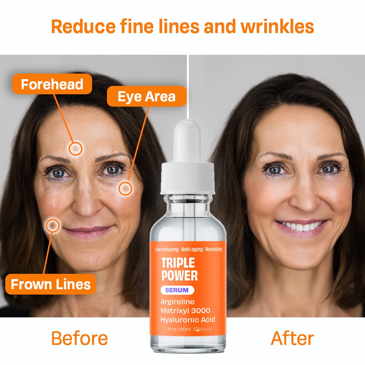 IQ Natural Argireline & Matrixyl 3000 Serum - Anti-Aging Peptide Serum for Face, Hydrating Face Serum for Women and Men, 1oz
