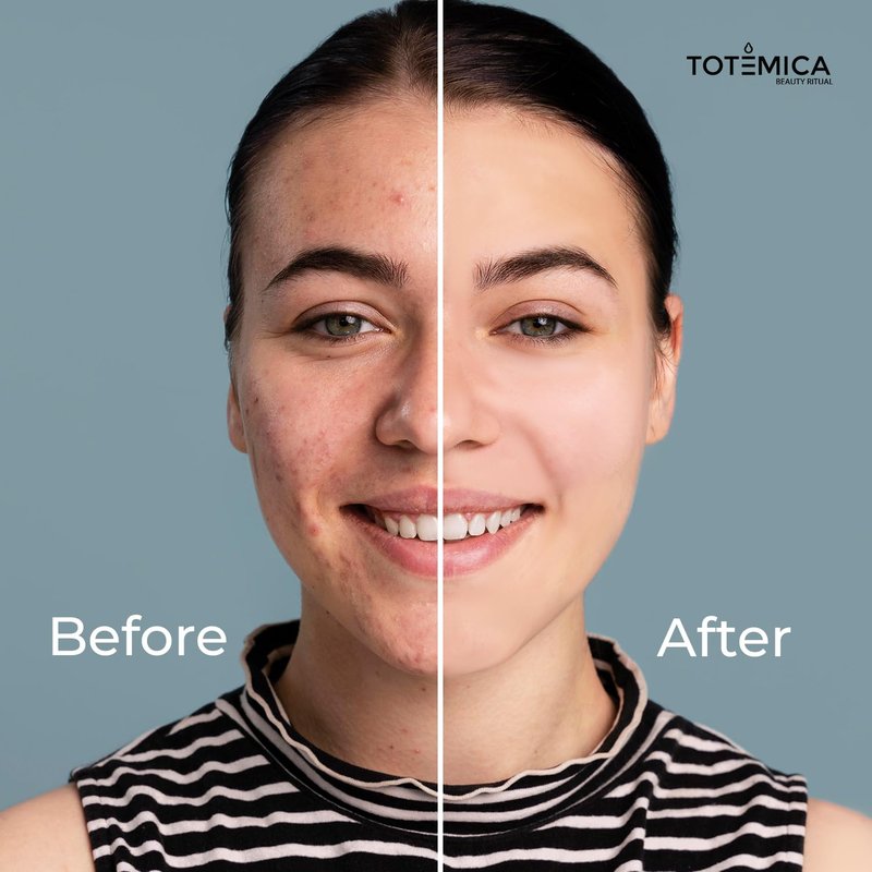 TOTEMICA Face Moisturizer with Niacinamide, Hyaluronic Acid, and Peptides, Wrinkle Filler Anti Aging Serum, Firming Moisturizer for All Skin Types - Vegan, Cruelty-Free (1.69 Fl Oz)