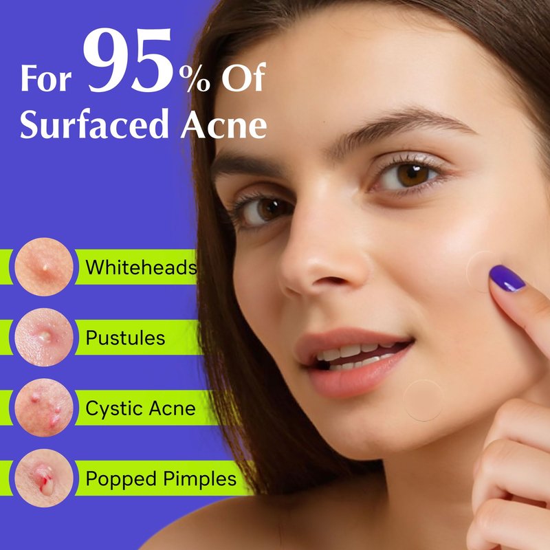 Voibon Pimple Patches For Face, Invisible Hydrocolloid Acne Patches Acne Treatment,Covering Zits & Blemishes in Skin and Face, Zit Patches with Salicylic Acid,