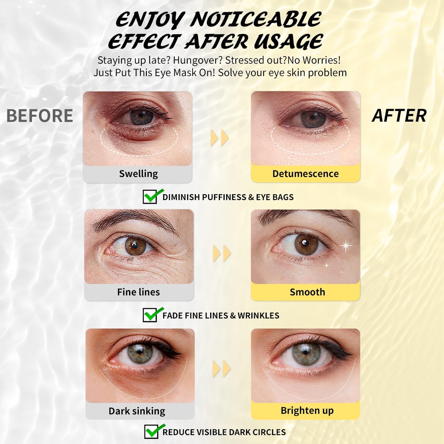 Maskiss Under Eye Patches (25 Pairs), Hyaluronic Acid Eye Masks for Dark Circles Puffy Eyes Undereye Bags, Collagen Eye Patches for Wrinkles and Hydrate, Eye Skin Care Christmas Gift for Women & Men