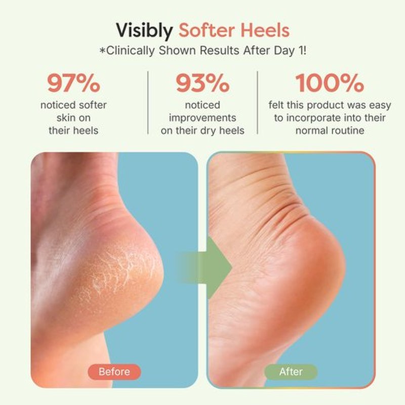 ZenToes Moisturizing Sleep Socks with Vitamin E, Olive Oil and Jojoba Seed Oil to Soften and Hydrate Dry Cracked Heels (Snowflakes, Regular)