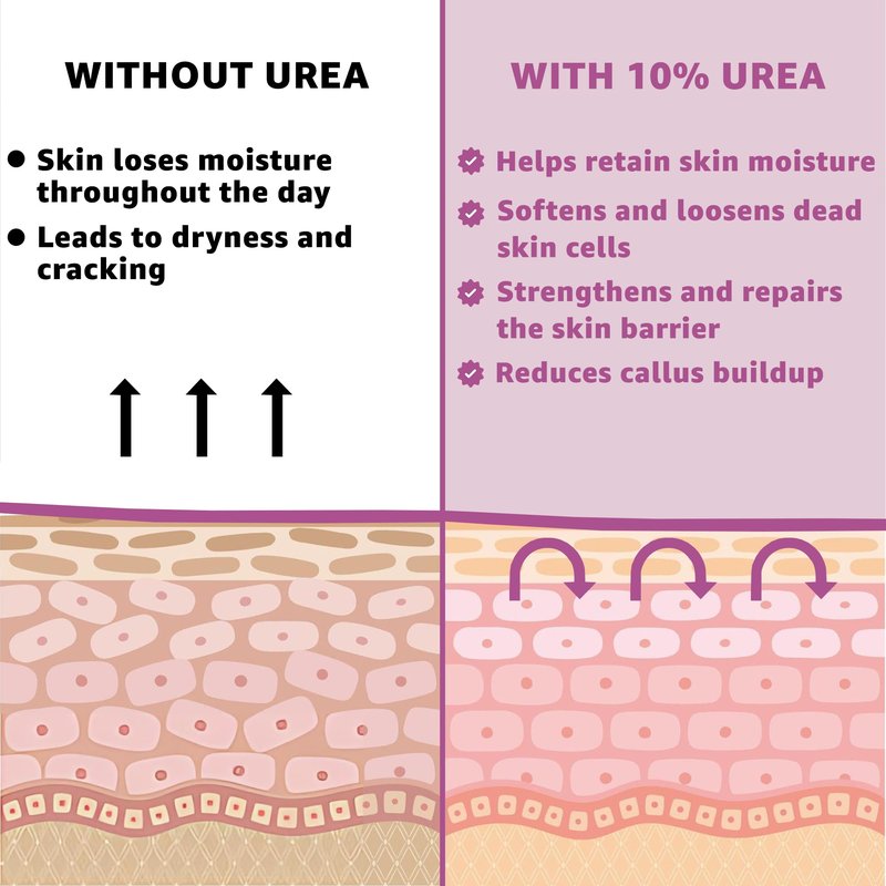 UREA LABS 10% Urea Cream with Aloe Vera, Jojoba Oil and Salicylic Acid - 150ml Hydrating Moisturizer for Dry, Chapped Hands, Feet, Face & Body - Repairs, Soothes & Nourishes Rough, Dry Skin - 4 Oz