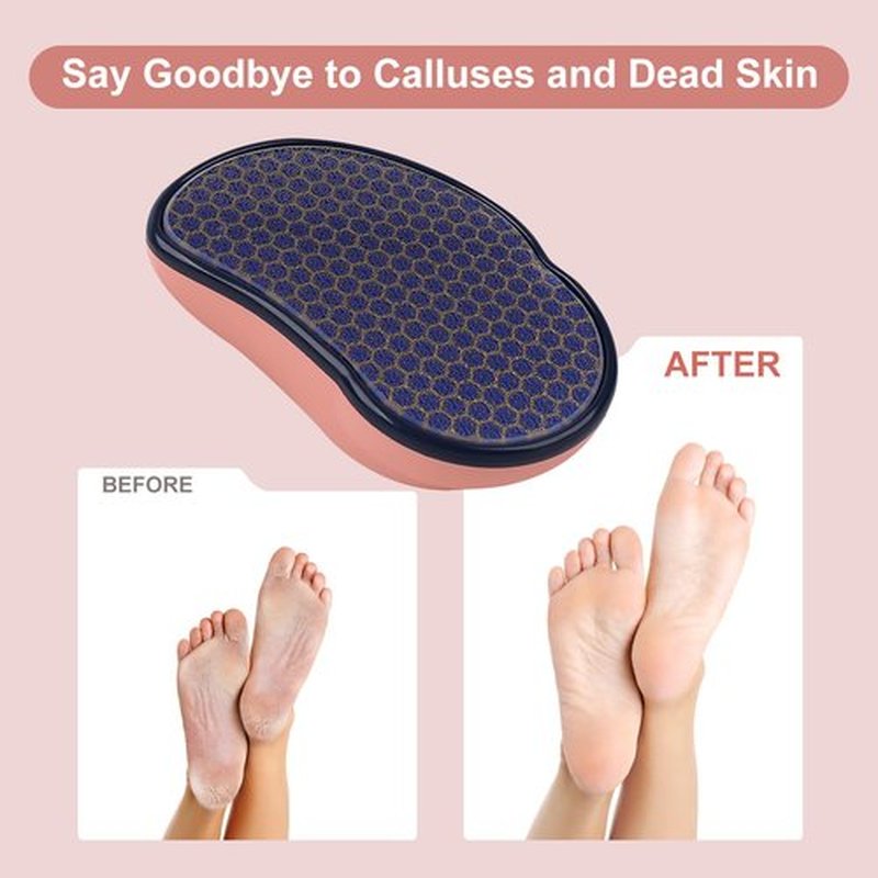 Uyoky Callus Remover Foot File, Glass Pedicure Foot Scrubber, Heel Scraper Hard Skin Remover for Feet, Ergonomic Design Foot Care Tool for Soft Skin (Pink)