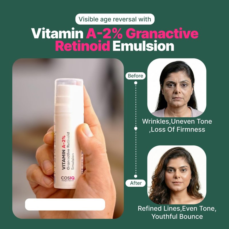 Cos-IQ Vitamin A-2% Granactive Retinoid Emulsion 30ml | Vit-A Anti Ageing for Wrinkles, Fine Lines & Acne | For Women & Men