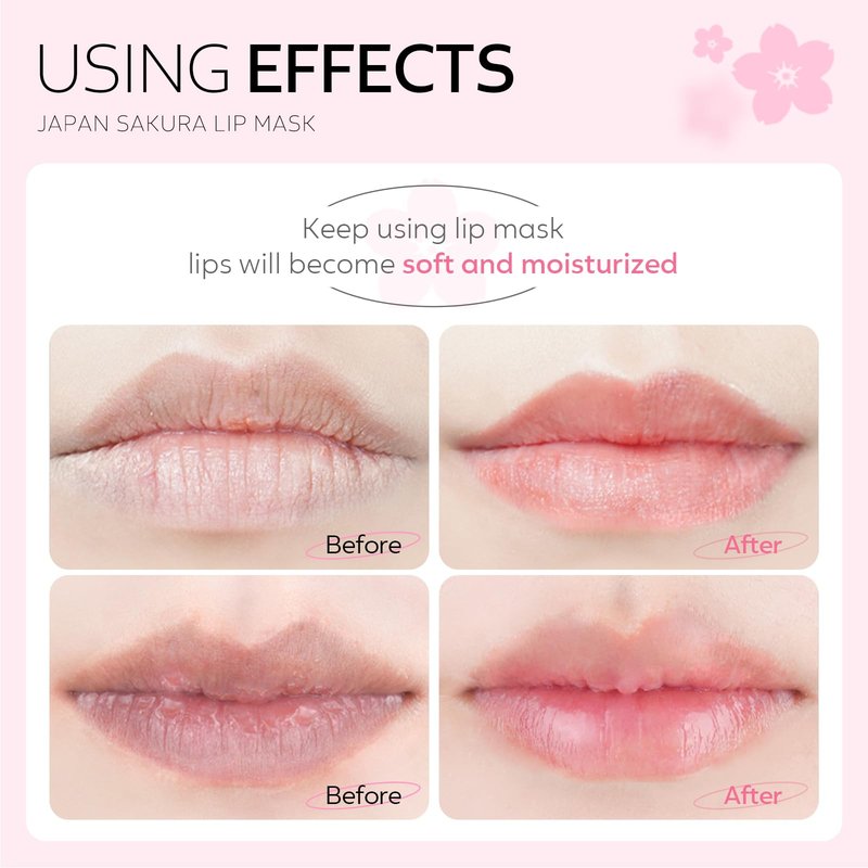 AKARY Sakura 10 Pieces Hydrating Lip Mask, Lip Sleep Mask Collagen Crystal Lip Care Gel Pads For Moisturizing, Minimize Fine Lines, Remove Dead Skin, Chapped Pads Lip Mask (10)