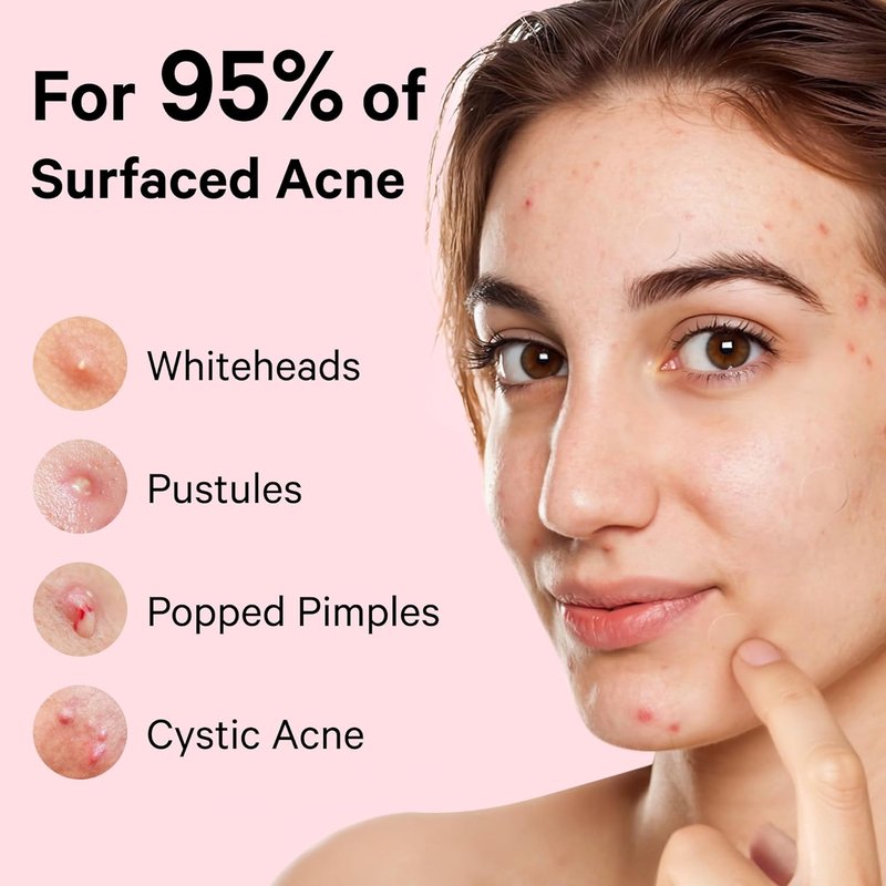 Sosky Pimple Patches - Hydrocolloid Acne Treatment with Salicylic Acid | 24 Count Invisible Zit Stickers