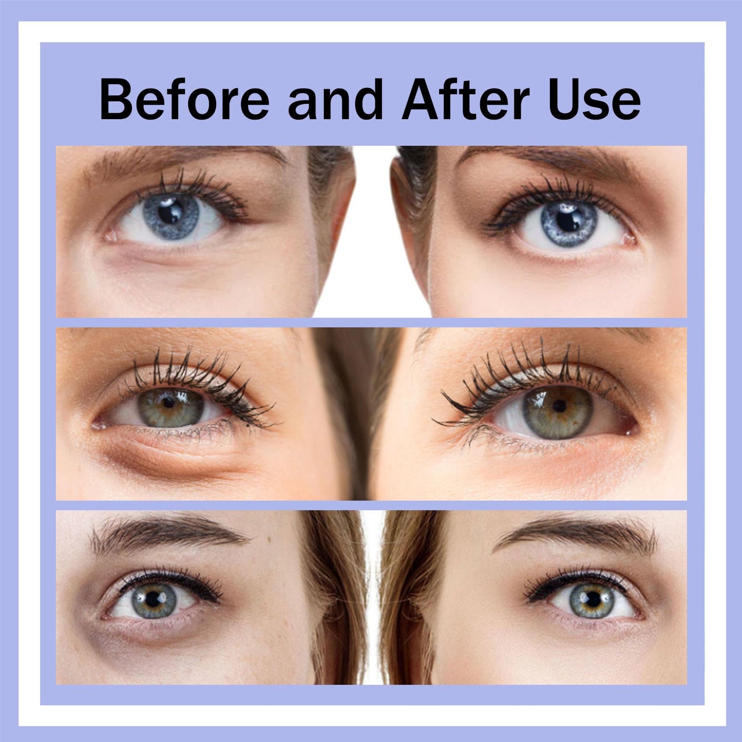 Botanique Paris Under Eye Device, Revitaleyes Under-Eye Therapy, Revital Eyes Glasses, Fade Dark Circles, Under-Eye Bags, Wrinkles, Fine Lines, Don’t Mask Aging, Rejuvenate It (1PCS)
