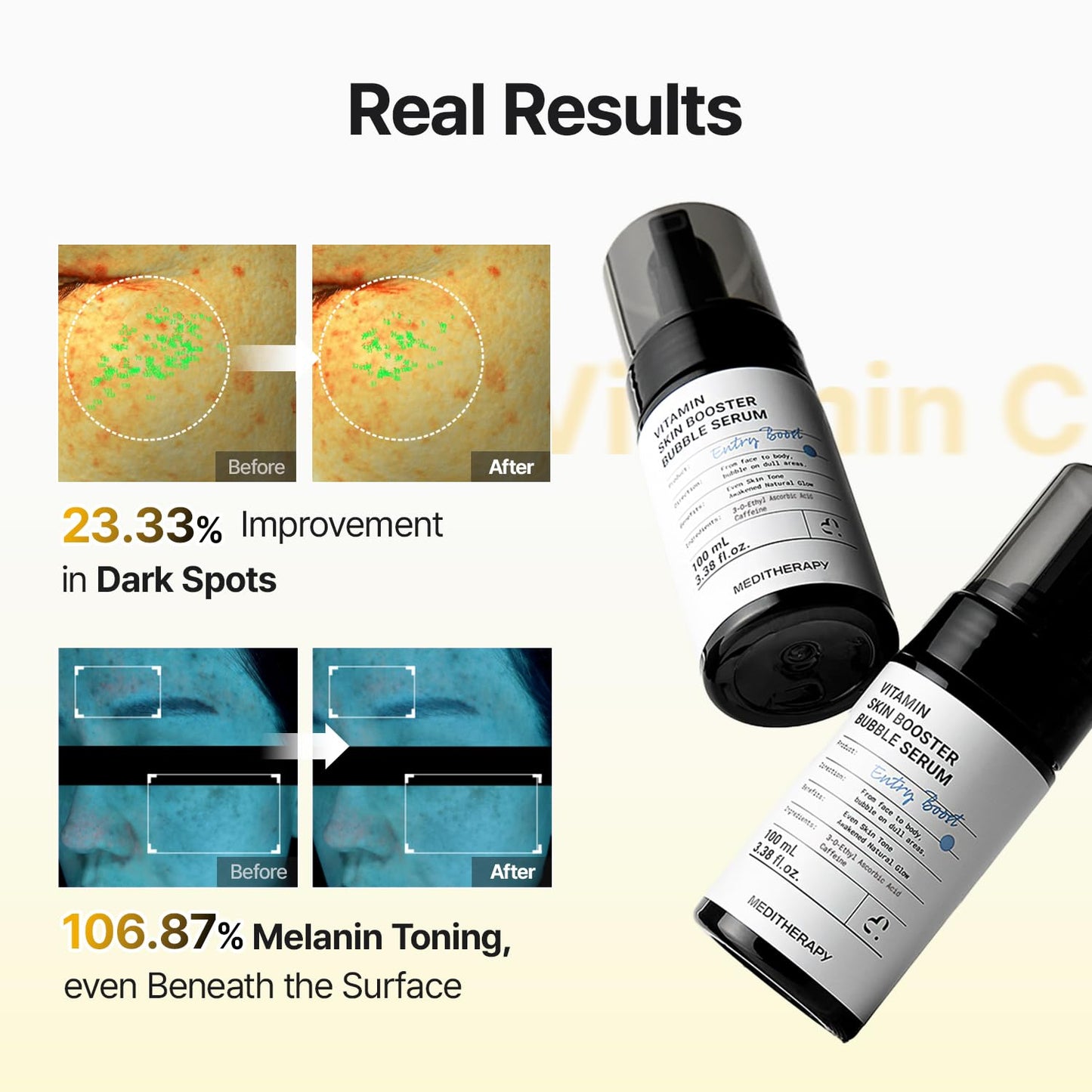 MEDITHERAPY Hyaluronic Acid Serum XXL 150ml (5.07 fl.oz.) – Ultra Hydrating 333Serum for Glowing Skin, Face Moisturizer, Non-Sticky, Anti-Aging & Wrinkle Care, Korean Skin Care