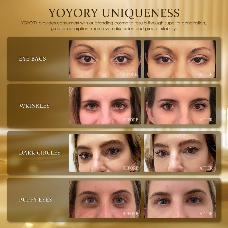 YOYORY Under Eye Patches Masks - for Dark Circles, Puffy Eyes, Fine Lines, Wrinkles, Eye Bags Treatment with Collagen and Hyaluronic Acid,Firming & Cooling, Moisturizing and Hydrating (60 Pcs) GOLD4