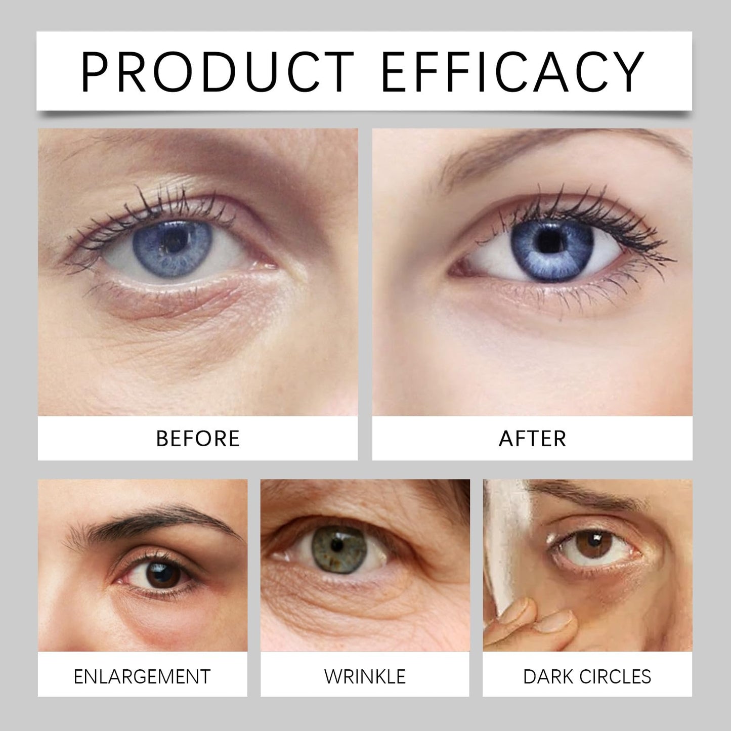LumiBalm for Under Eye Bags, Under Eye Balm Stick Hydrating, Turmeric Retinol Eye Cream Stick, Eye Bags Serum for Puffy Bags Under Eyes, Erases Eye Bags Within 3-4 Weeks Reduces Fine Lines (2)