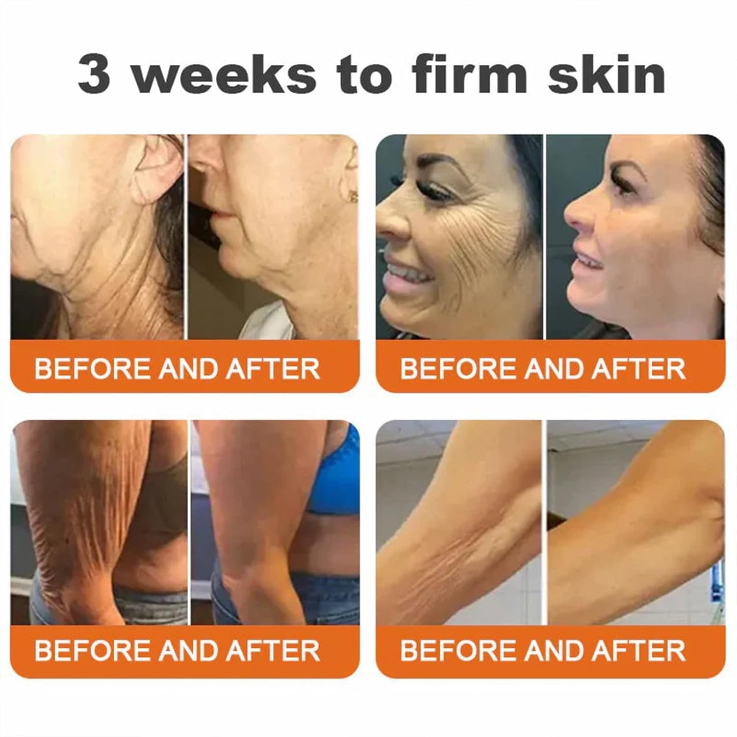 Bee Venom Skin Restoration Cream,Natural Bee Venom Comprehensive Cream,Effectively Firms skin and Reduces Imperfections Anti-Wrinkle Moisturizing for All skin Typess (2PCS)