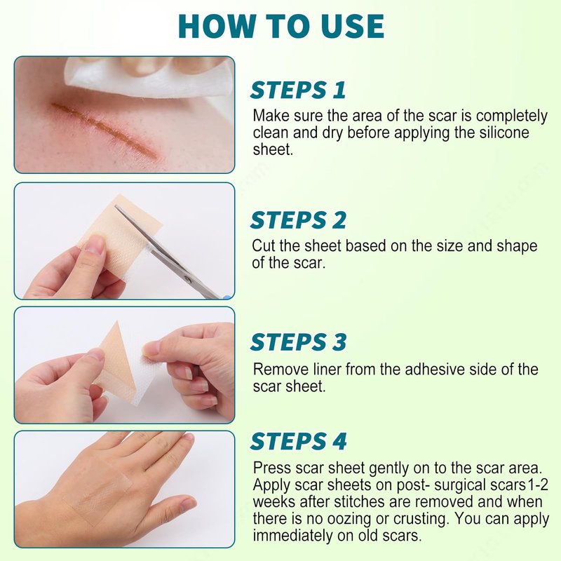 2 Pack Silicone Scar Sheets, Silicone Scar Tape, Scar Sheets for Surgical Scars, Reusable Silicone Scar Strip For Surgical, C-Section,Tummy Tuck, Keloid Scars, Burn, Acne, Removal