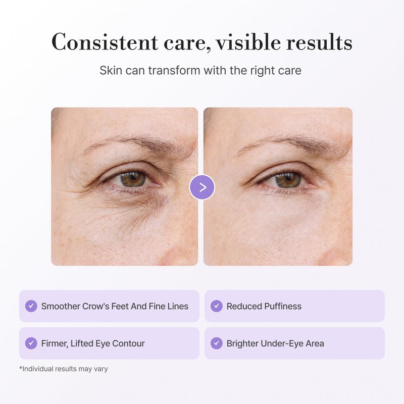 Lepique Peptide-Matrix Eye Cream – Structural Firming and Lifting with Matrixyl® 3000, Ginseng, TECA Centella for Wrinkles, Pores, Crow’s Feet, Dark Circles, Korean Anti-Aging Skincare 0.5 oz