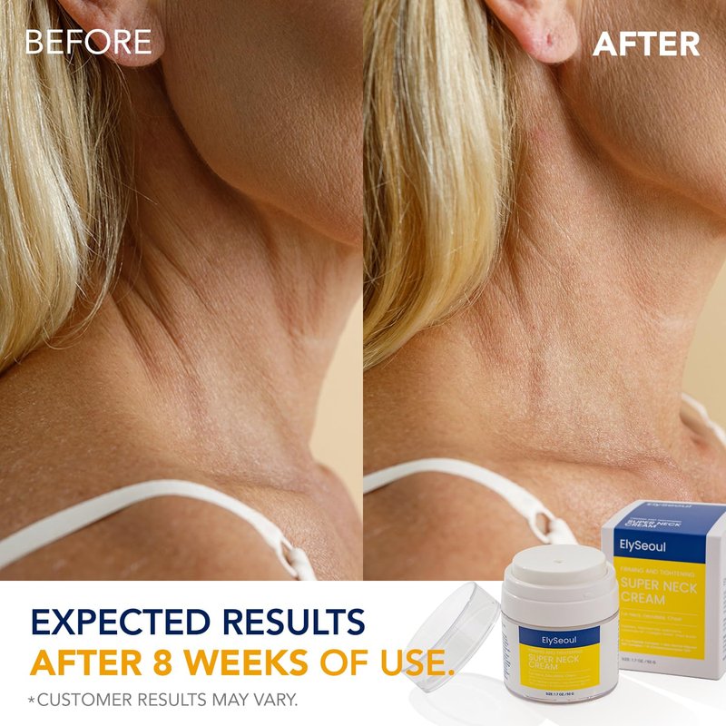 ElySeoul Korean Neck Cream for Firming & Tightening: Neck & Chest Anti-Aging Treatment for Crepey Sagging Skin & Wrinkles
