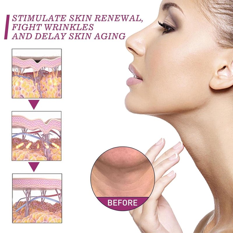 Hydrolized Collagen Neck Cream - Firming & Tightening Anti-Aging Formula for Sagging Skin | 1 oz