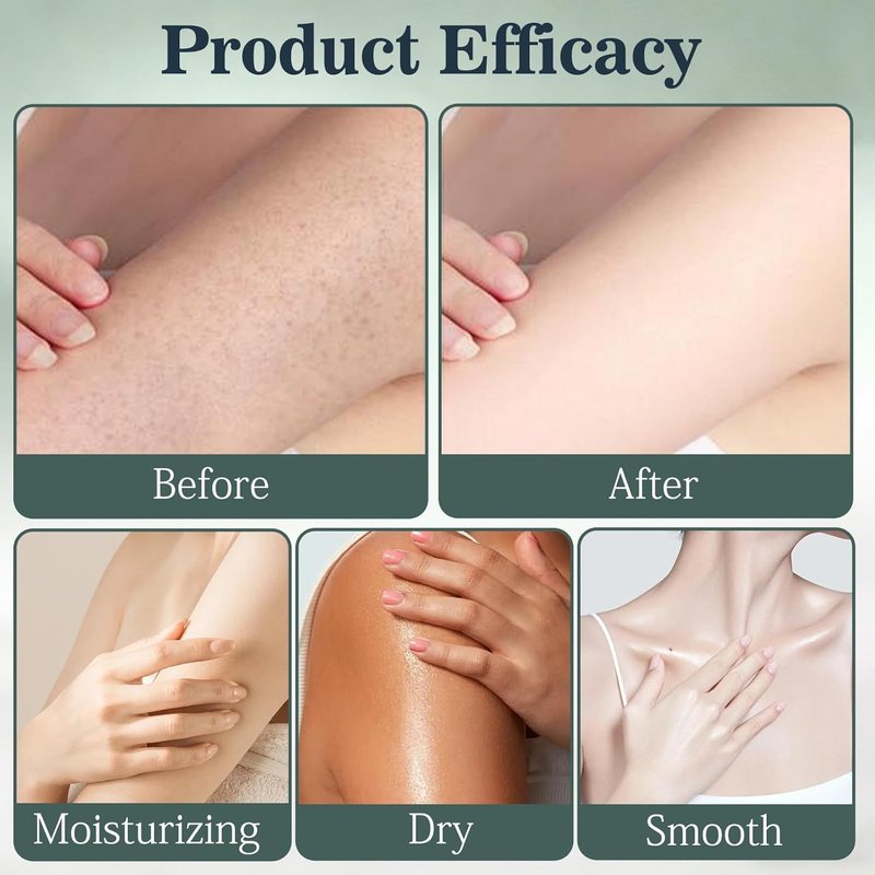 BIKCITV Intertrigo Cream,Skin Fold Care & Chafing Support Cream, Supports Skin Comfort, Fast-Drying Non-Greasy Formula for Daily Use-1BOX