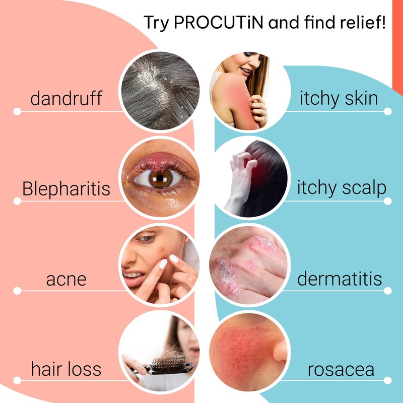 OZIDEX Procutin Rosacea | Dermatitis | Acne | Solution to Demodex | Natural Herbal Formula