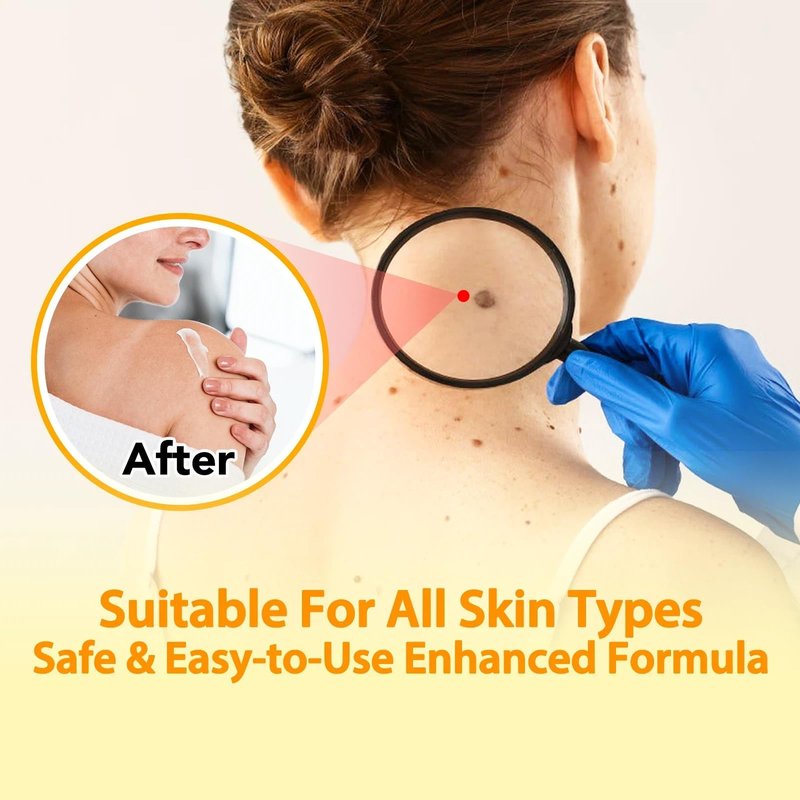 ITSDAWN Bee Venom Cream, Bee Venom Skin Cream, Hydrating Moisturizing Cream for Face and All Parts of the Body 100g / 3.52 oz