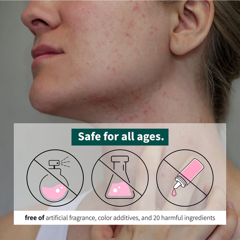 PCALM Cato Barrier Super Calming Ceramide Facial Lotion 6.76 Oz Unscented Not Greasy Soothing Hydrating Moisturizer for All Skin Types Acne-Prone Sensitive Dry Oily Combination Hypoallergenic Korean