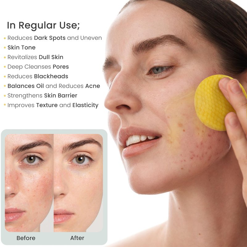 RAXAC Kojic Acid & Turmeric Facial Cleansing Pads, 50 Count, Vitamin C, Gentle Exfoliating Cotton Pads for Brighter & Refreshed Looking Skin, Daily Facial Cleansing Pads