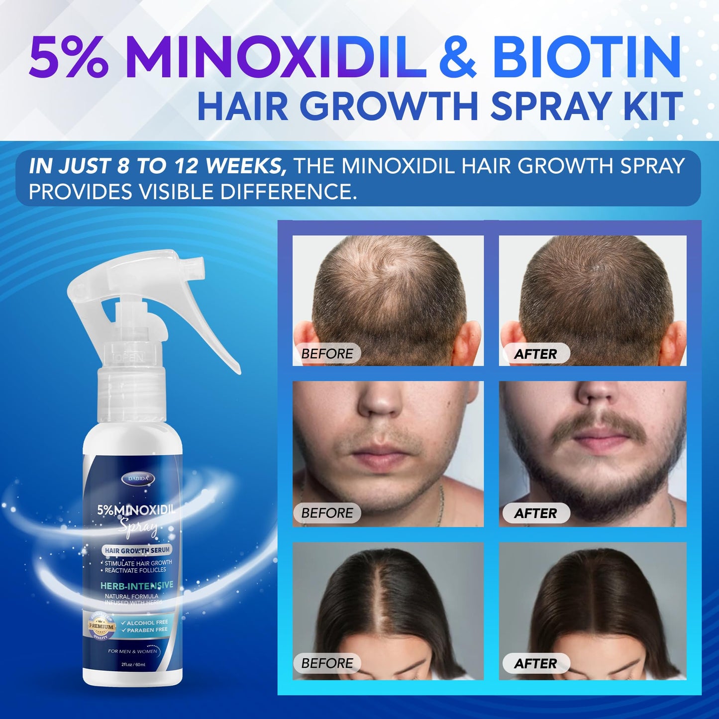 5% Minoxidil Spray for Hair & Beard Growth, Hair Regrowth,Hair Loss Treatments for Men & Women 60ml * 3bottles
