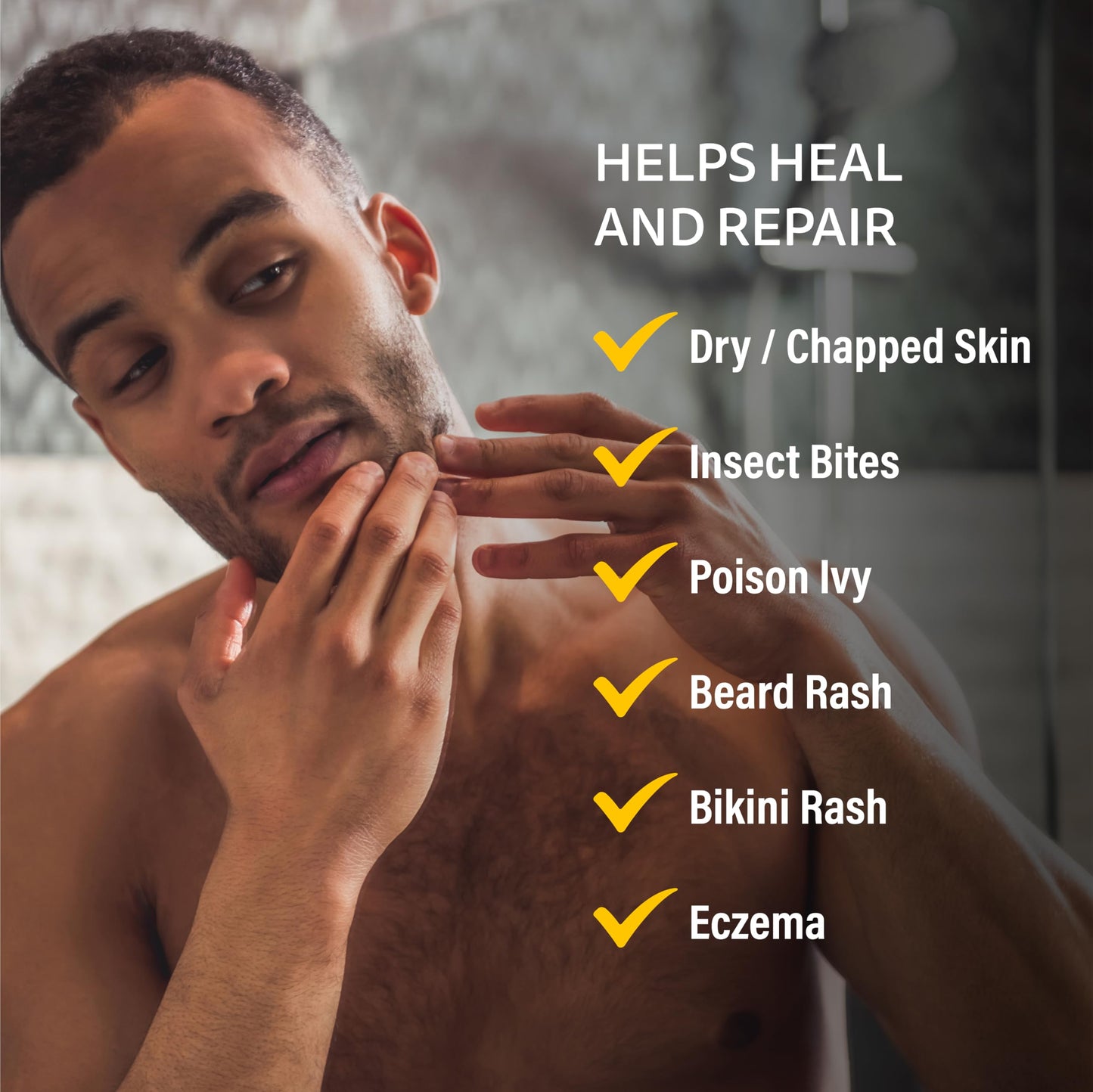 A+D Medicated Rash Ointment 1.5 oz– Relieves Rash & Skin Irritated Skin from Poison Ivy, Eczema, Beard, Bikini, Dry Skin, Chapped Skin, bug bites. Made with Colloidal Oatmeal
